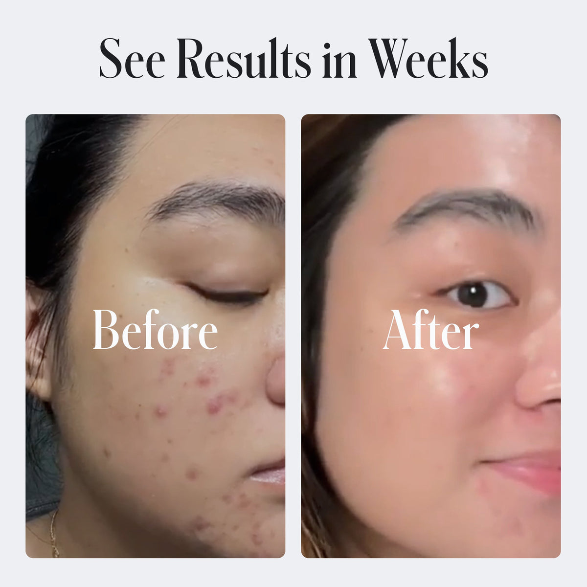 Clear Skin Face Cream