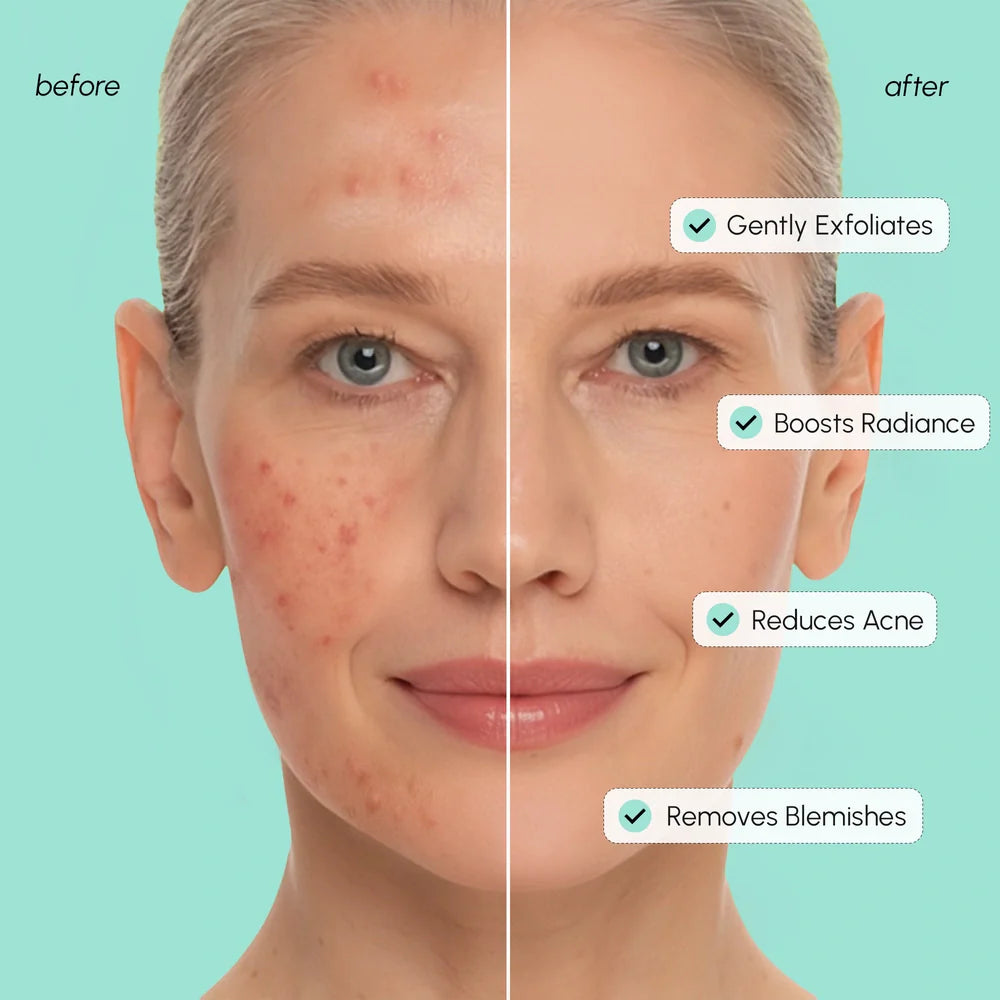 MAREE Azelaic Acid Soothing Pads