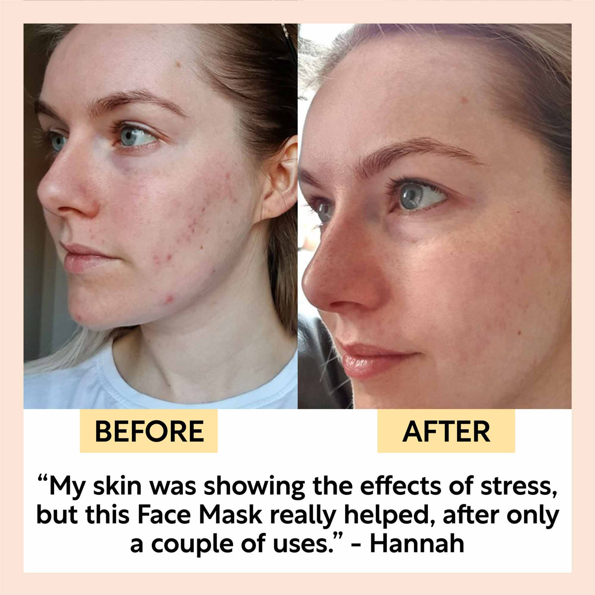 UPCIRCLE Kaolin Clay Face Mask