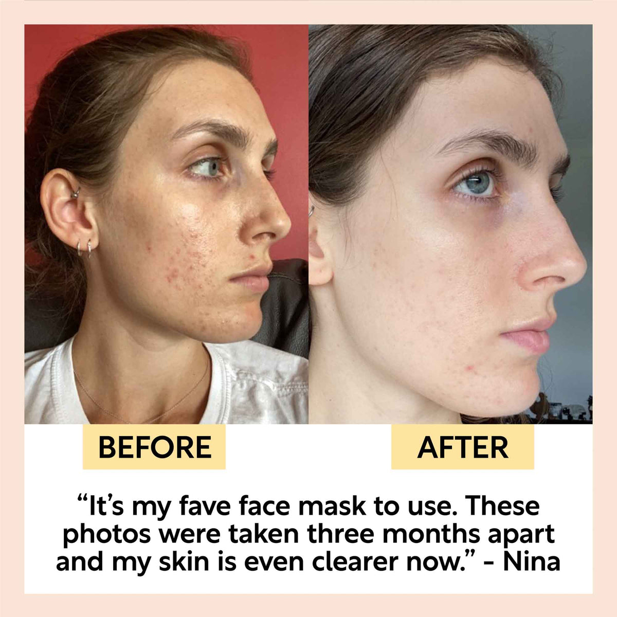 UPCIRCLE Kaolin Clay Face Mask