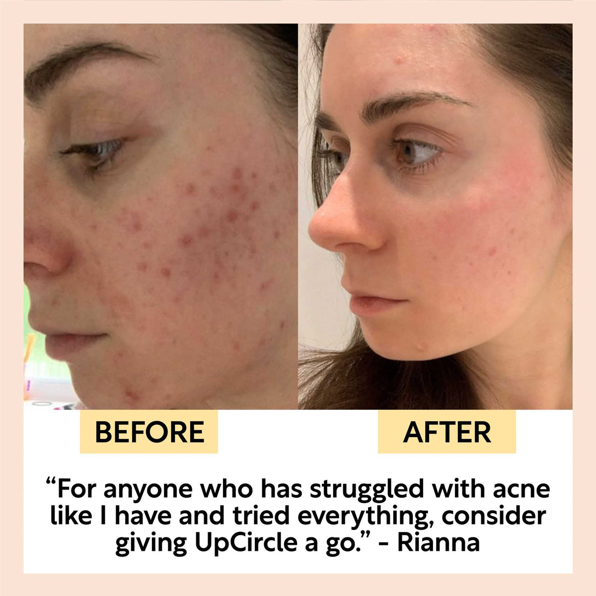 UPCIRCLE Travel-Size Skincare Bundle