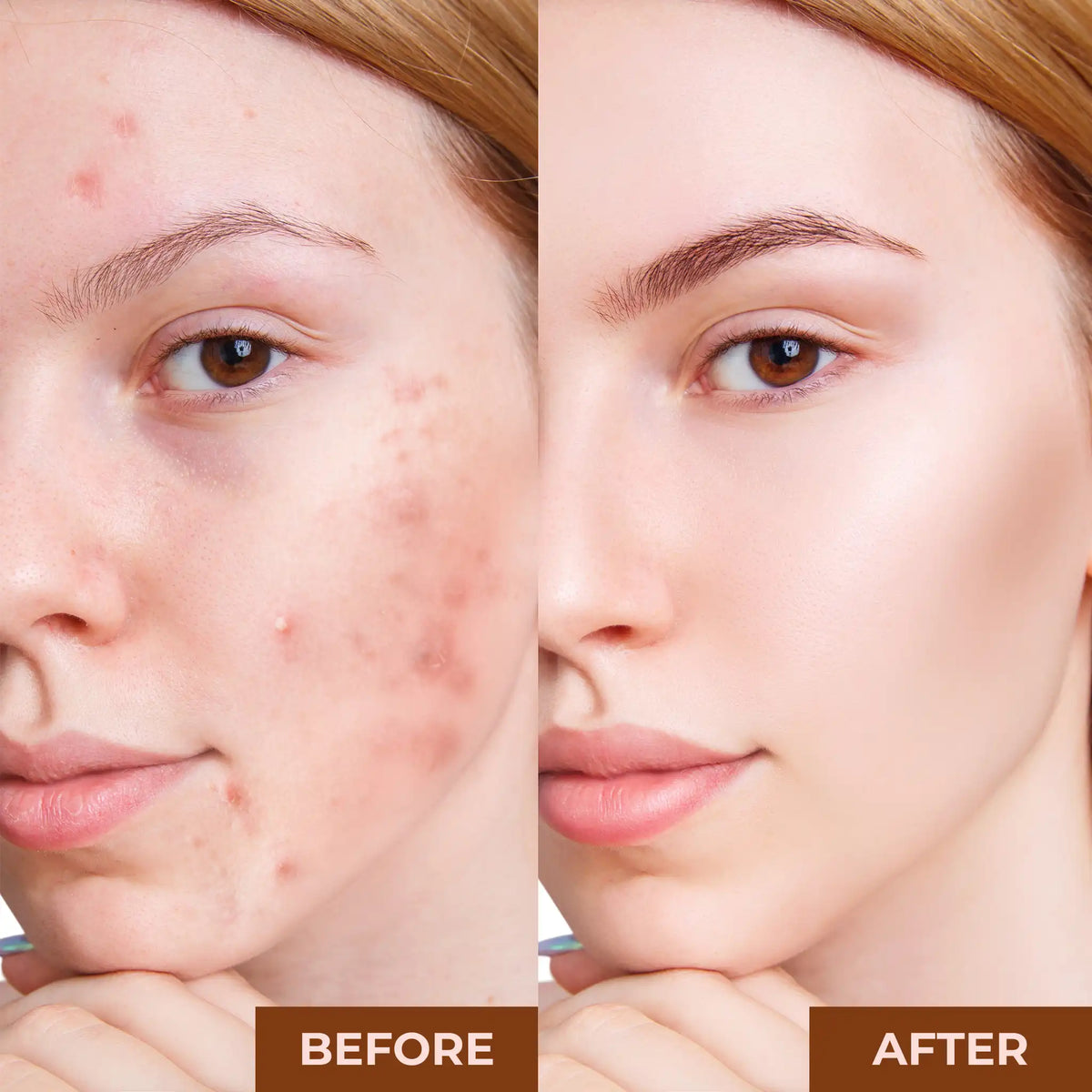PROLUX Best Pore Minimizing Primer by Prolux