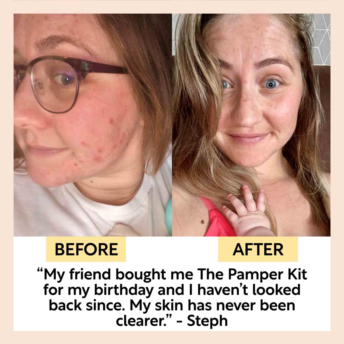 UPCIRCLE "Pamper + Gift" Skincare Kit