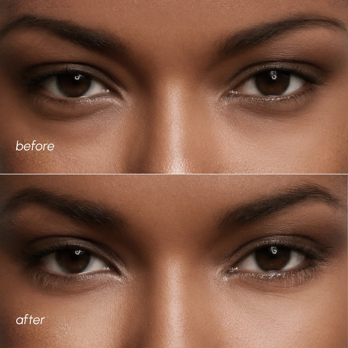 MAREE Violet Eye Patches for Dark Circles