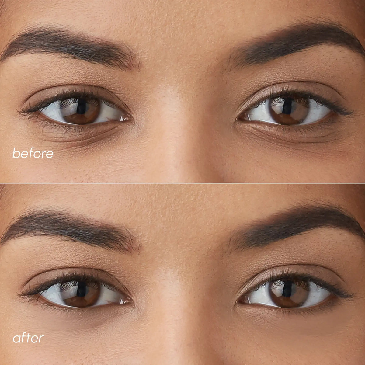 MAREE Violet Eye Patches for Dark Circles